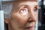 Glaucoma eye disease, Glaucoma latest breaking, all about the eye disease glaucoma, Eyes