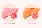 Grade 2 Fatty Liver medication, Grade 2 Fatty Liver latest breaking, how to reverse grade 2 fatty liver, Cholesterol