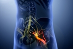 Sciatica issues, Sciatica nerve disorder, help yourself on sciatica, Pinched nerve