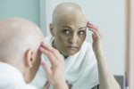 Chemotherapy, Chemotherapy for cancer, new cancer treatment prevents hair loss from chemotherapy, Cancer treatment