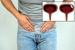 Bladder Cancer reasons, Bladder Cancer reasons, why is bladder cancer common in men, Unhealthy eating habits