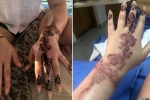 fashion and beauty, henna tattoo side effects, henna tattoo cause aussie woman to almost lose her hand, Tattoos