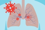 Covid-19, immune system, how does covid 19 affect different parts of the body, Covid toe