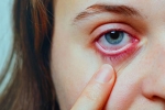 Conjunctivitis prevention, Conjunctivitis research, special measures to prevent conjunctivitis, Body organs